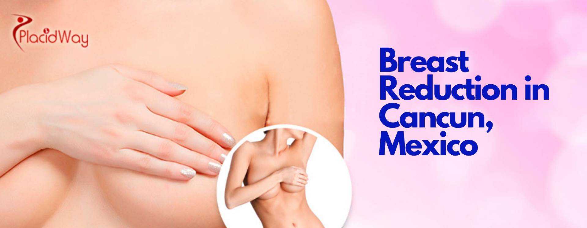 Breast Reduction in Cancun Mexico